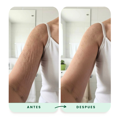 Dermalift™ - Crema reparadora de piel - 2x1