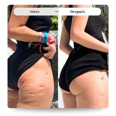 FirmFlow - Masajeador corporal