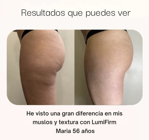 LumiFirm™ - Banda reafirmante de muslos